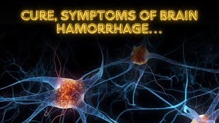 WARNING SIGNS OF BRAIN HEMORRHAGE  Do Not Ignore These Signs Of Brain Hemorrhage  Prevention Cure [upl. by Phemia355]