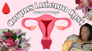 Daisy vs Ovarian Cyst amp Internal Bleeding  STORYTIME [upl. by Uhn]