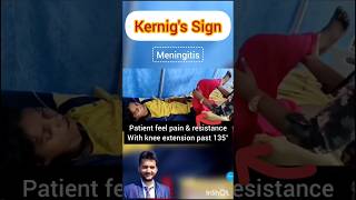 Kernigs sign meningitis shorts medical nursing NORCET [upl. by Akemyt721]