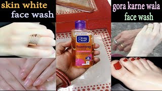 1 ही बार के इस्तेमाल से चेहरा इतना गोरा खूबसूरत कर देगा skin white face wash oily skin [upl. by Bibah965]