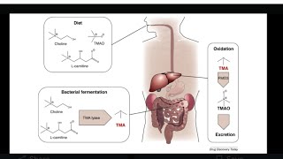 mystery diagnosis trimethylaminuria [upl. by Elurd]