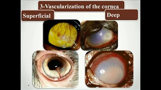 Affections of the cornea part 6 [upl. by Znieh]