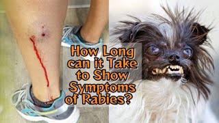 How Long can it Take to Show Symptoms of Rabies And What are the Common Symptoms and Prevention [upl. by Enytsuj]