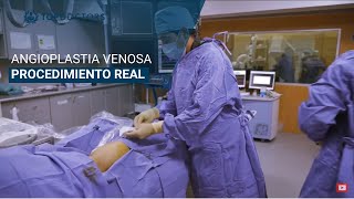 Procedimiento Angioplastia Venosa con balón stent CASO REAL [upl. by Clayson]