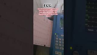 📈ecg heart beats cardiac function signal ytshorts video short [upl. by Layol]