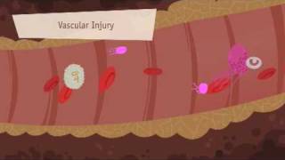 Hemostasis Coagulation and Fibrinolisis [upl. by Wemolohtrab]