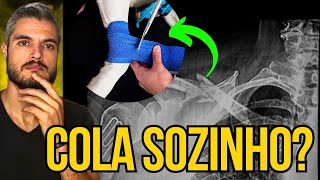 CACHORRO COM FRATURA COMO RESOLVER SEM FAZER CIRURGIA CARA NO VETERINÁRIO CÃO MANCANDO COM DOR [upl. by Jesh]