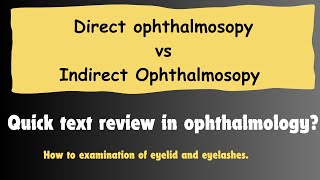 Difference Between quotDirect Ophthalmoscopyquot and quotIndirect Ophthalmoscopyquot Important Topics for exam [upl. by Olfe]