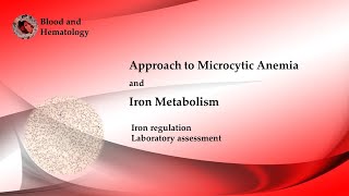 Approach To Microcytic Anemia [upl. by Mientao]