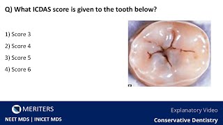 NEET MDS  INICET  Conservative Dentistry  Explanatory Video  MERITERS [upl. by Htebizile]