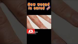 How wound is cured timelapse shorts woundhealing [upl. by Ibson]