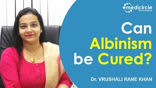 Can Albinism be cured  Treatment for Albino Child  Dr Vrushali Rane Khan [upl. by Annekcm]