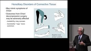 Chiari Surgery Expectations amp Recovery  William Tobler MD amp Lisa Cleveland PT [upl. by Aldas]