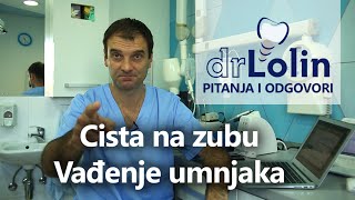 Dr Lolin TV  Emisija 2  Pitanja i odgovori Cista na zubu Vadjenje umnjaka [upl. by Nnyleimaj]