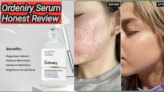 The Ordinary Hyaluronic Acid 2 B5 Serum Honest Review Winter skincare Best Serum For Winters [upl. by Resee844]