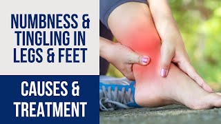 Leg amp Foot Numbness amp Tingling Diagnosis amp Treatment [upl. by Angelina458]