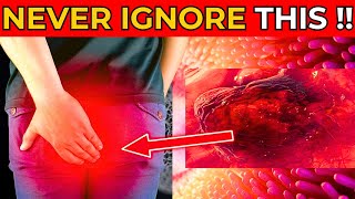 Early SIGNS of COLON CANCER you MUST NOT IGNORE [upl. by Adnaram]