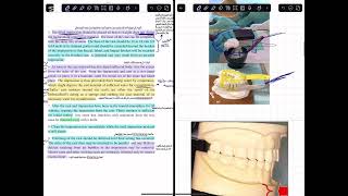 شرح prosthodontics lec 6step by step procedure for making a stone cast طب اسنان مرحلة رابعه [upl. by Scully684]