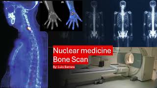 3mt Nuclear medicine Bone Scan LB [upl. by Annawal510]