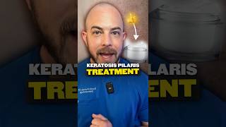 What is keratosis pilaris Derm explains keratosispilaris [upl. by Leynad849]