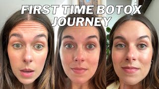 GETTING BOTOX FOR THE FIRST TIME Why I did it my experience and results [upl. by Eerb]