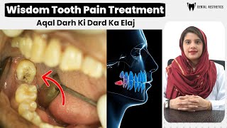 Wisdom Teeth Pain Treatments Aqal Darh Ki Dard Ka Ilaj  Why You Need Wisdom Tooth Extraction [upl. by Ahsla]