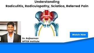 Radiculitis Radiculopathy Sciatica amp Referred Pain  Explained [upl. by Irehs]