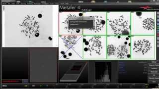 DCScore  Automated Scoring of Dicentric Chromosomes [upl. by Georgia]