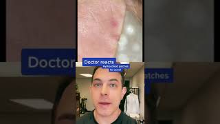 Do hydrocolloid patches work Dermatologist answers  208SkinDoc [upl. by Seitz]