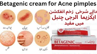 Cream Betagenic Uses And Price In PakistanShahid Madicine Info [upl. by Oca]