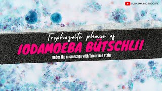 Trophozoite phase of Iodamoeba bütschlii under the microscope with Trichrome stain [upl. by Nnalorac]