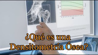 ¿Qué es una Densitometría Ósea [upl. by Yelad]