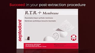 The effortless placement of RTR Membrane [upl. by Enyt]