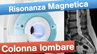 Risonanza Magnetica lombare  Quando e come eseguirla [upl. by Gorski]