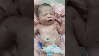 oily skin newborn baby👶😱🩺💉🏥shortsshortvideoshortsfeedbabybabyshortsbabyvideosnicuniculife [upl. by Daniell]