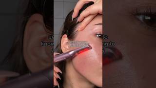 everything you need to know about dermaplaning in one video dermaplaning breakout glowingskin [upl. by Ahsiadal]