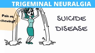 Know trigeminal neuralgia with new treatment [upl. by Cigam443]