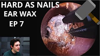 Hard As Nails Ear Wax EPISODE 7 [upl. by Dmitri]