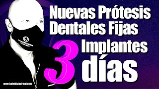 SORPRENDENTE forma de REEMPLAZAR Todos los DIENTES con estos Nuevos Implantes [upl. by Adnesor584]