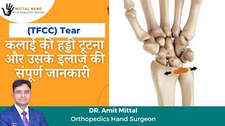 TFCC Injury In Hindi  TFCC Tear Repair Surgery And Stretches  कलाई की हड्डी टूटना व उसका उपचार [upl. by Aicul]