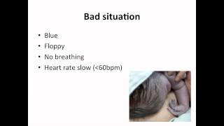 Paediatrics  neonatal resuscitation [upl. by Amsaj]