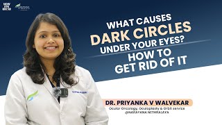 Dark circles under your eyes  know how to get rid of it  Dr Priyanka V Walvekar [upl. by Bilicki452]