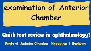 Anterior chamber of eye  Anterior segment examination  Anterior chamber angle OptometryFans [upl. by Imelda426]