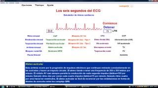 ECG  SIMULADOR DE RITMOS CARDIACOS [upl. by Terbecki712]