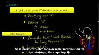 Semundja e valvulave te zemres regurgitimi i valvules mitral dhe prolapsimi i valvules mitrale 7 [upl. by Ahsineb]