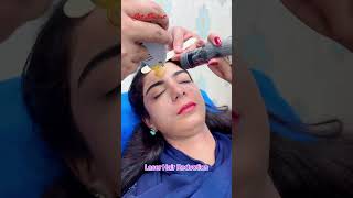 Laser Hair Removal getsmarthairclub beauty hair [upl. by Xenophon]