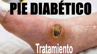 TERRIBLE PIE DIABÉTICO 🦶 CUIDADOS Y TRATAMIENTO 👏 DR IVAN GUTIÉRREZ CIRUJANO VASCULAR  FLEBOCENTER [upl. by Eseneg282]