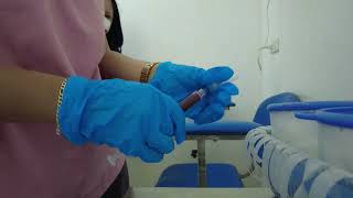 TACROLIMUS DAY BLOOD EXTRACTION DAY [upl. by Alveta]