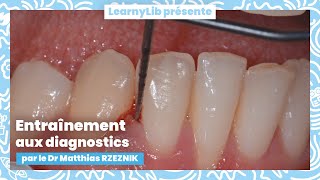 🦷 La parodontie  entraînement aux diagnostics avec le Dr Matthias RZEZNIK [upl. by Hesper]