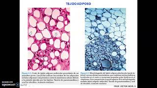 Clase Tejidos Conjuntivos parte V [upl. by Monjo]